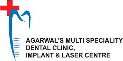 Agarwal’s Multispeciality Dental Clinic, Implant & Laser Center