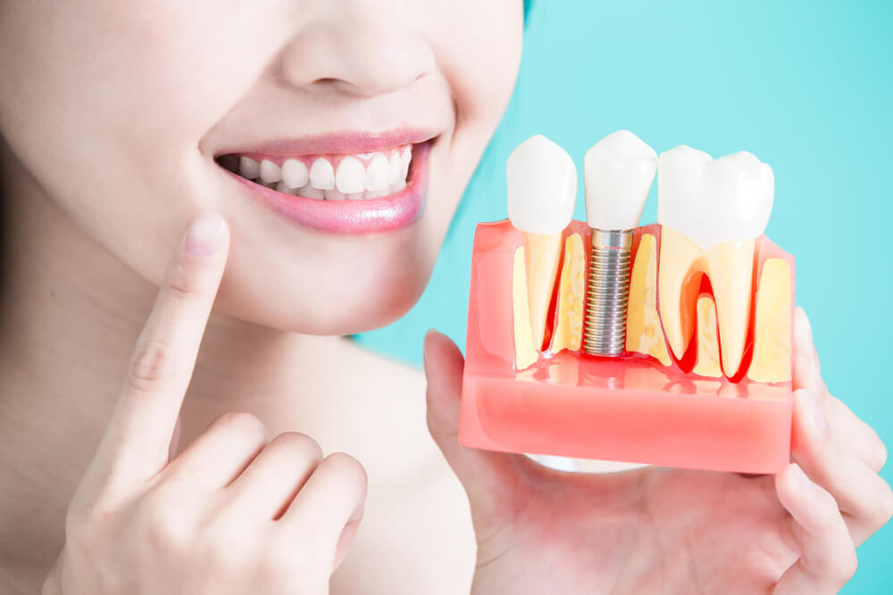 Why You Should Consider Dental Implants: A Permanent Solution for a Confident Smile