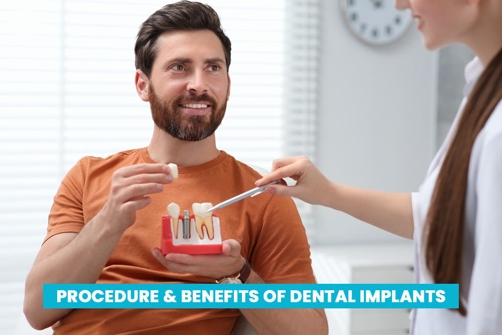 Dental Implants – Procedure and Benefits