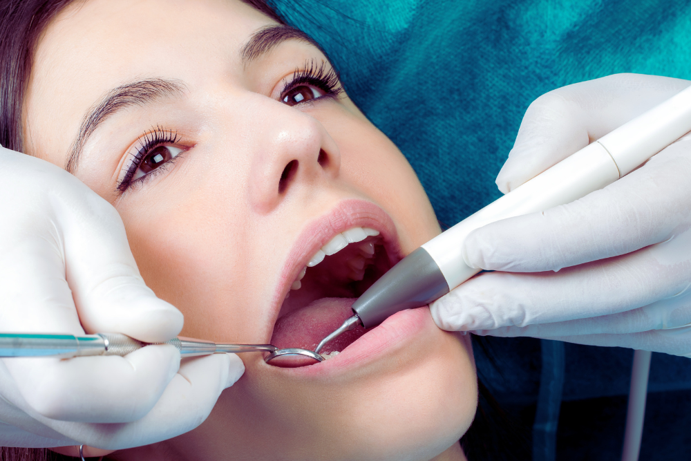 Best Teeth Care in Ahmedabad – Scaling vs Cleaning