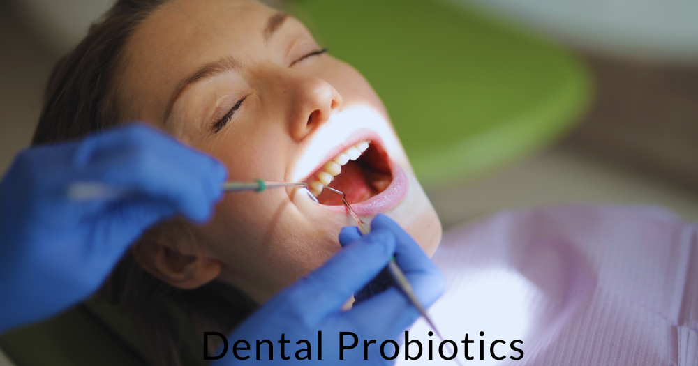 Top 5 Benefits of Using Dental Probiotics